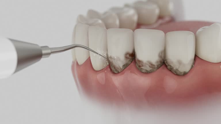 Trusted Emergency Dentist service in Lancaster, CA - Dentist Open Now